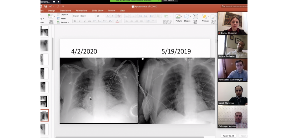 A screenshot of Armenian medical providers examining lung x-rays on a Zoom call
